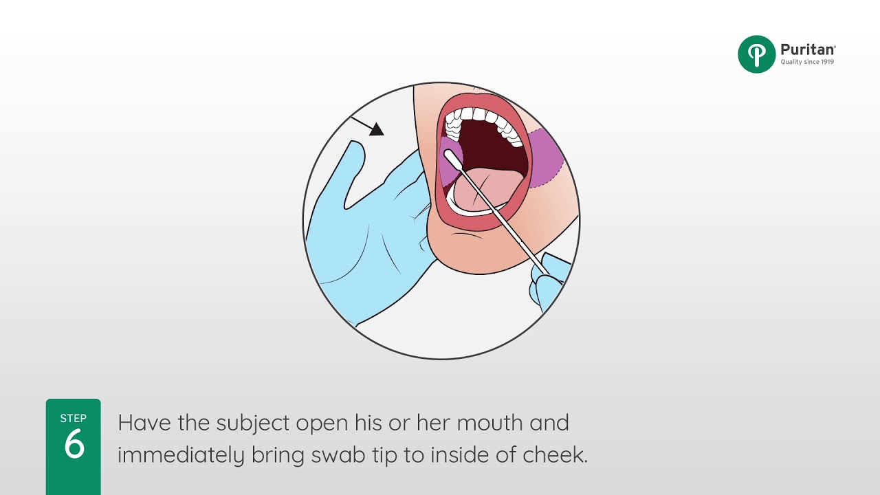 How To Collect A Buccal Swab Sample For Forensic Analysis YouTube How To Collect A Buccal Swab Sample For Forensic Analysis YouTube