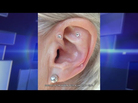 Video: Slimming Earring - Types, Principles, Methods, Contraindications