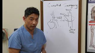 Carotid Artery Surgery with Dr. Eugene Tanquilut