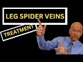 Leg spider veins treatment 5 essential facts about leg spider vein removal for doctors and nurses