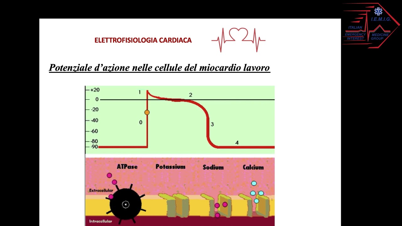 Interpretazione dell'ECG in Triage inf.  Luca Becheroni