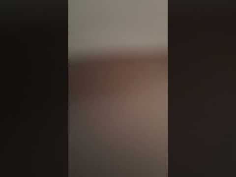 #merveleemyers #advocate s@YouTube @tiktok @instagram @NHS #discriminationexposed