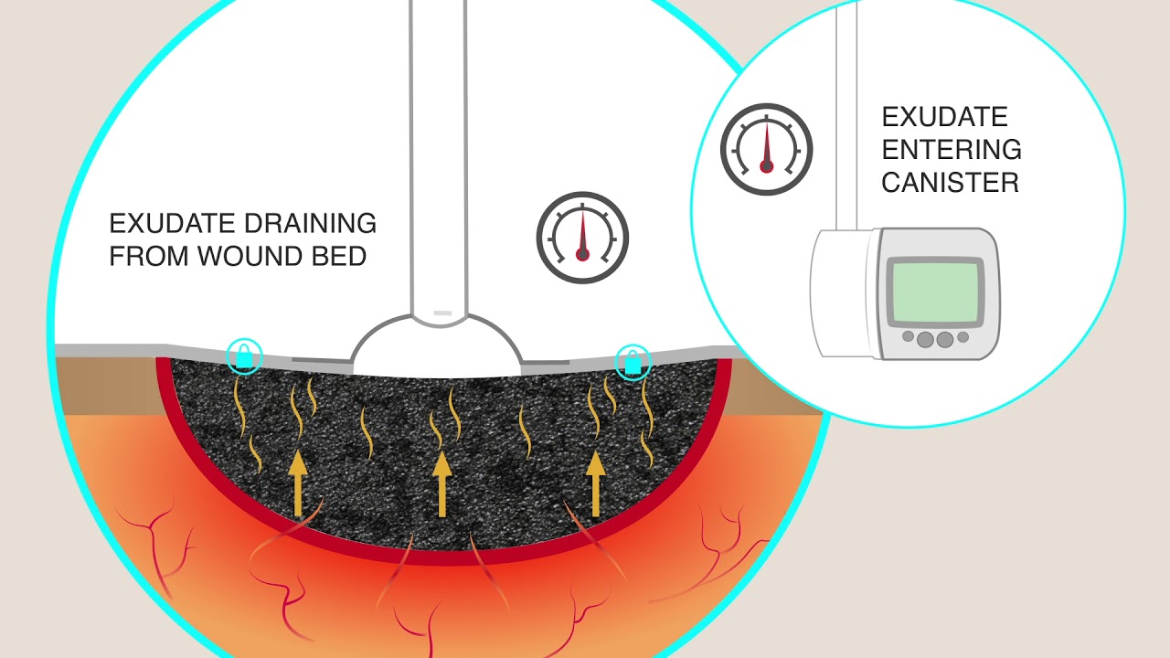 Science of the Patch YouTube