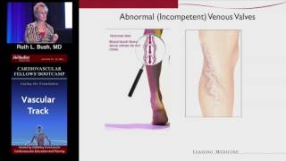 Diagnosis and Management of Varicose Veins (Ruth Bush, MD) Saturday, August 20, 2016