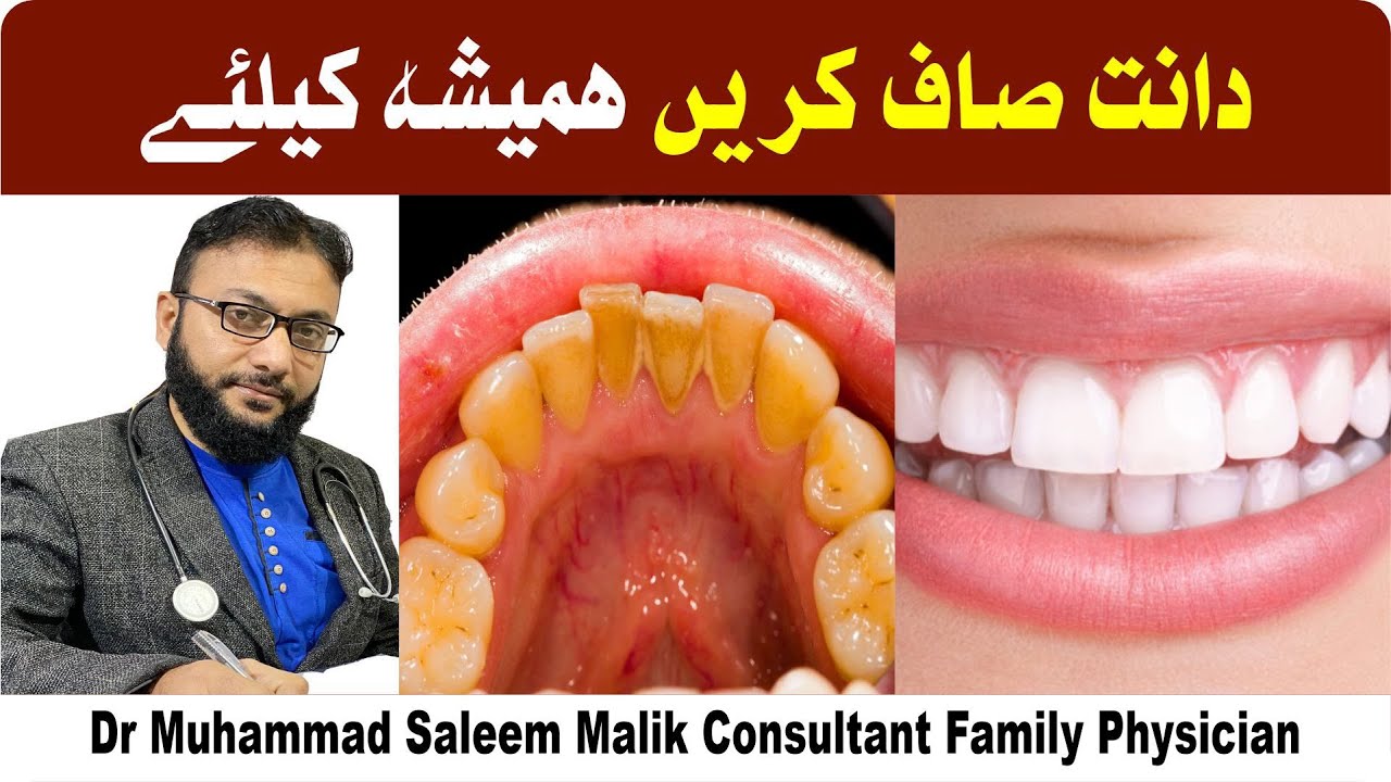 1 Home Remedy to Remove Dental Plaque & Tarter to Prevent Cavities by