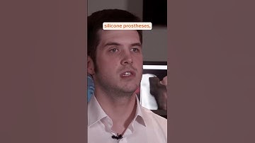 Khi công nghệ In 3D có thể thay đổi số phận #thinksmart #formlabs #in3d #3dprinting #3dprinted