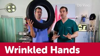 Wrinkled Hands ✋👋 | Operation Ouch | Da Vinci TV