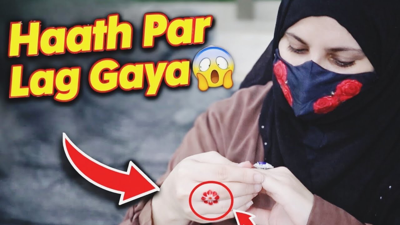 OMG! Haath Par Ye Kya Ho Gaya 😨