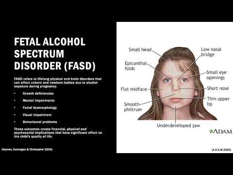 HAS130 Assignment - Alcohol Use in Pregnancy - YouTube