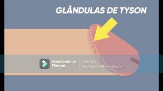 Como Eliminar Las Pápulas Perladas Glándulas De Tyson Con Pasta Dental.