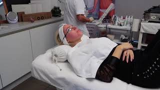 Laserbehandeling voor Lotte Feyen bij Skinline Clinic