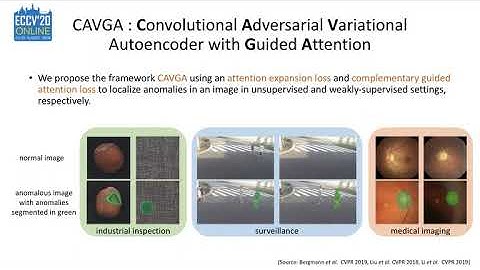 [ECCV 2020] Attention Guided Anomaly Localization in Images