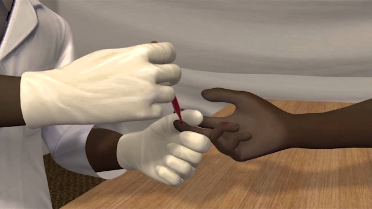 Malaria mortality rate cut by half since 2000, World Health Organization says