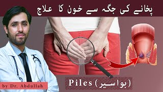 What is Hemorrhoids 3 Common Bawaseer Ki Alamat In Urdu | Piles Bleeding Treatment At Home