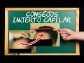 CONSEJOS INJERTO de PELO por CIRUJANO