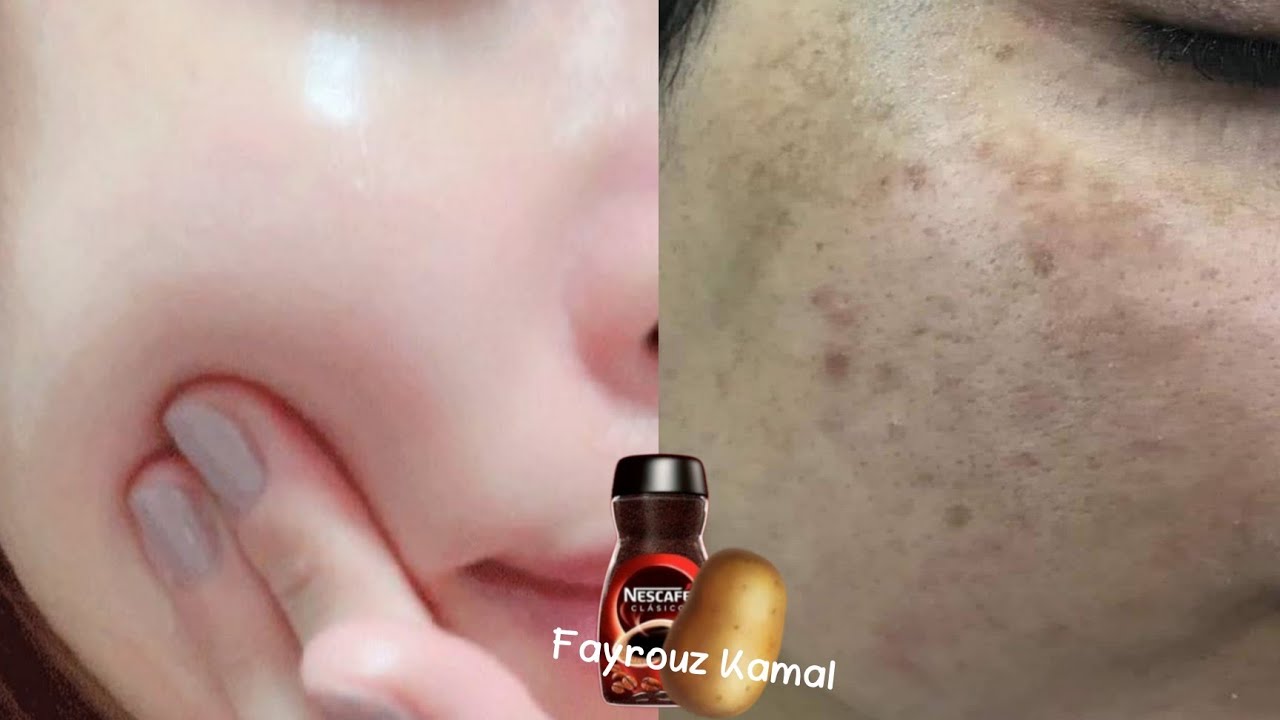 القهوة والبطاطس 🥔 لن تصدق النتائج أقسم بالله ندمت إني ماعرفتها من زمان جربيها بنفسك