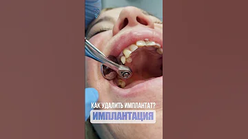 Как удалить имплантат? How to remove the implant? #dentist