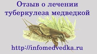 Отзыв на лечение туберкулеза легких медведкой азиатской(Лечение туберкулеза легких медведкой - правда или вымысел? Один из наших клиентов, который заказывал сушен..., 2016-07-26T13:11:59.000Z)