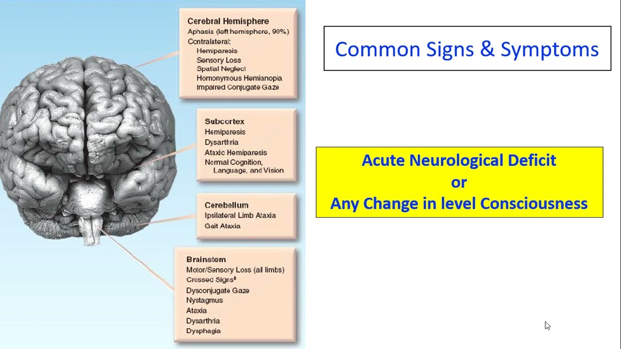 A patient with sudden onset slurring of speech with limb weakness HD WEB