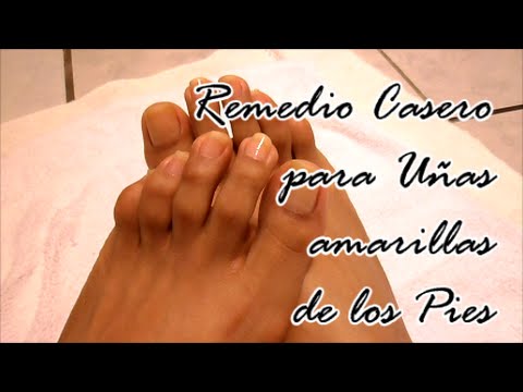 Como lograr tener las de los Pies blancas?/How to your toe and white ? - YouTube