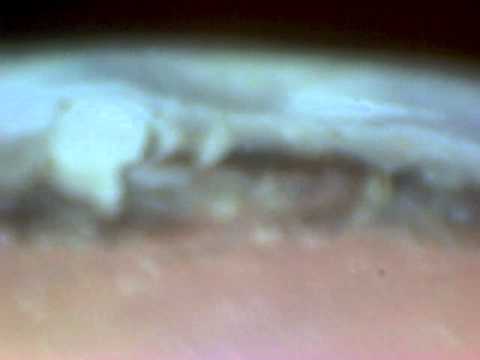 Under The Microscope The Dirty Fingernail Youtube