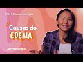 [#4] Microcirculação: EDEMA e a EQUAÇÃO DE STARLING | MK Fisiologia
