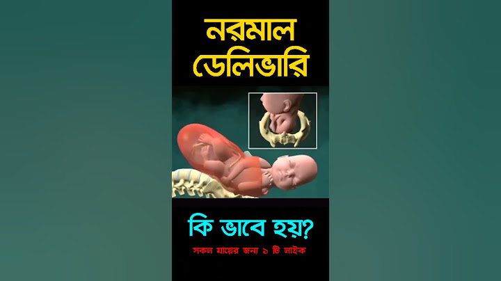 নরমাল ডেলিভারি কি ভাবে হয়?Normal delivery #shorts