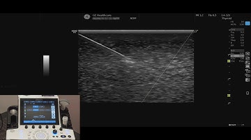 LOGIQ P9 Tutorials: B-Steer+