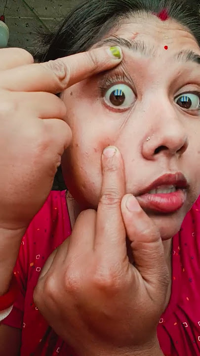 My eye ball slpped out #shorts 🤪