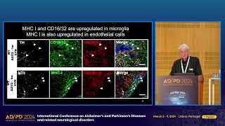 AD/PD 2024 : Pr Dan Lawrence for Lys Therapeutics (Parkinson's Disease)