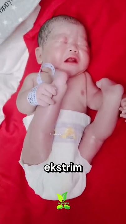 Why Can Babies Be Born with Their Feet on Their Heads?