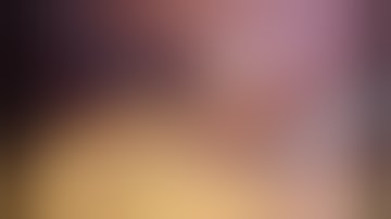 Laparoscopic left partial nephrectomy - dr Vladan Andrejevic