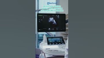Lesti Kejora Hamil Lagi sebelum Setahun Melahirkan, Waspadai Risikonya, Ini Jarak Ideal Kehamilan