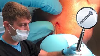 Needle In A Haystackfoot