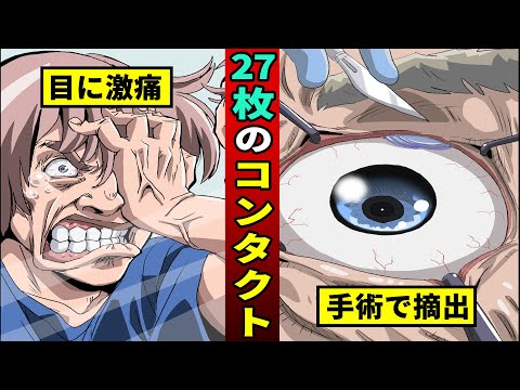 目の中からコンタクトレンズが27枚…コンタクトで失明した事件も・・・