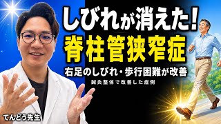 脊柱管狭窄症で右足がしびれて歩けなかった50代男性が鍼灸整体で改善！日常生活が楽になった