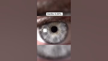 Thumbnail of Rarest Eye Colors In The World..
