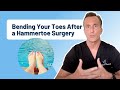 "Can You Fold Your Toes From The Pip Joint After a Hammertoe Surgery?" | ASK DR. MOORE