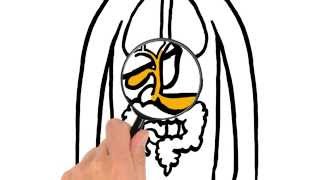 Uitleg Ercp Onderzoek Galwegen En Alvleesklier - Ziekenhuis Gelderse Vallei