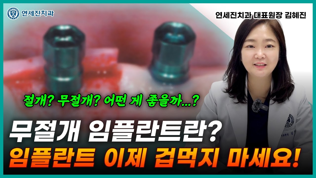 무절개 임플란트란? 임플란트 시술 이제 겁먹지 마세요!