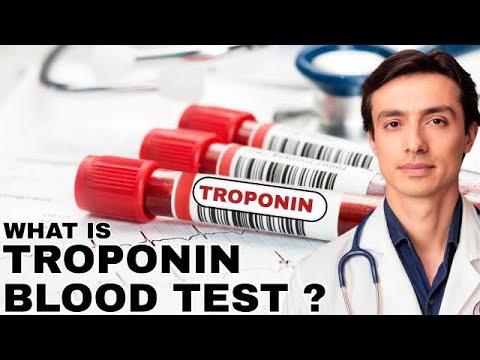 Cardiologist Explains Troponin Blood Test