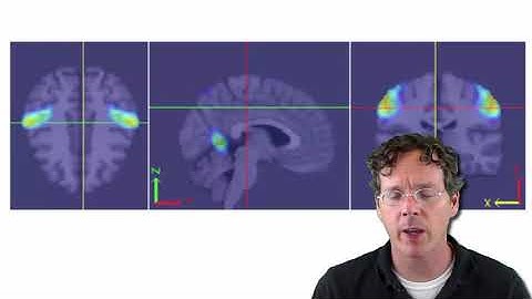 Statistical Inference, Introductory video   Johns Hopkins University Coursera