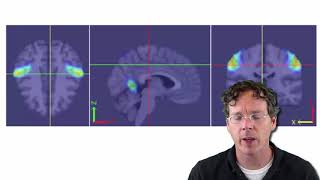 Statistical Inference, Introductory video   Johns Hopkins University Coursera