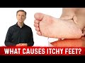 What causes itchy feet and how to stop it  dr berg