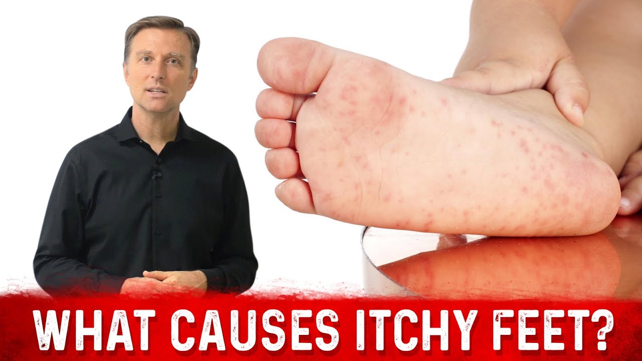 What causes sudden and intense itching in one's feet? What helps stop it? -  Quora