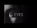 Eyelid Surgery NYC | Treating Tired Eyes with Dr. Bryan Forley