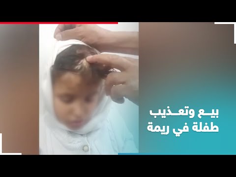 عذبتها وحاولت بيعها.. أسرة في ريمةتزوّر عمر طفلة من أجل تزويجها برجل مسن