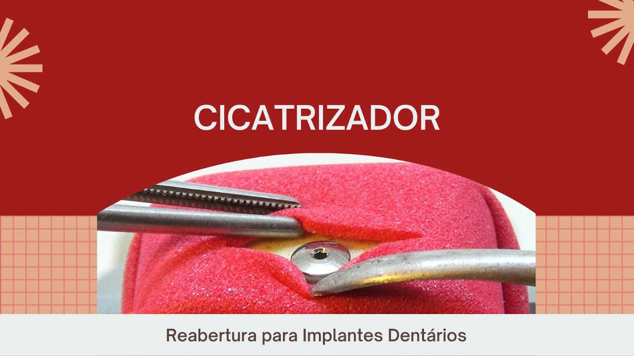 IMPLANTE - Cicatrizador - segunda etapa