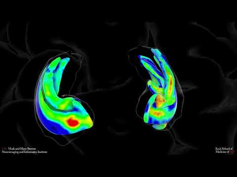 Averaged hippocampal subfields