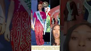 Nigeria just held its first-ever Albinism Advocacy Pageant! #fashion #beauty #skin #africa #hottopic